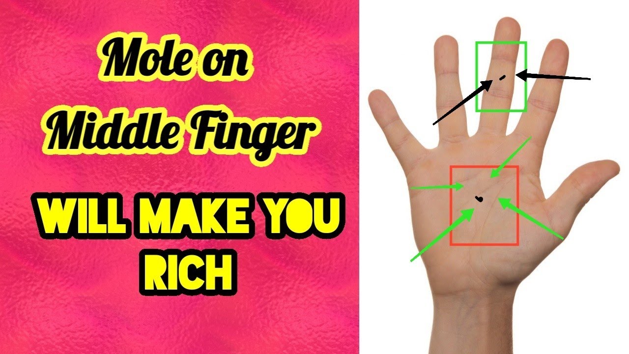Know the meaning of moles on the palm of your hand